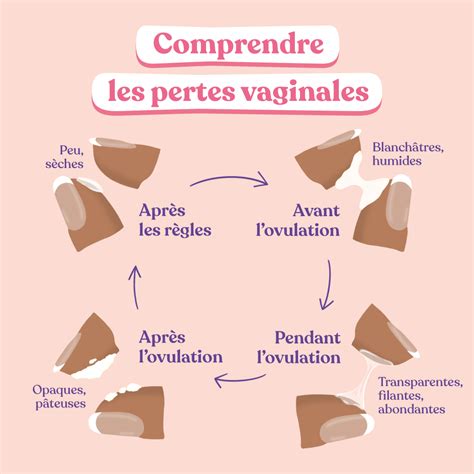 perte blanche infection|Pertes vaginales blanches, quand sinquiéter et quand。